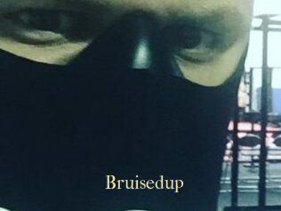 Bruisedup